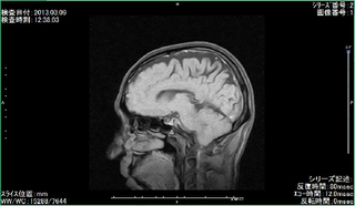 20130309-MRI.jpg
